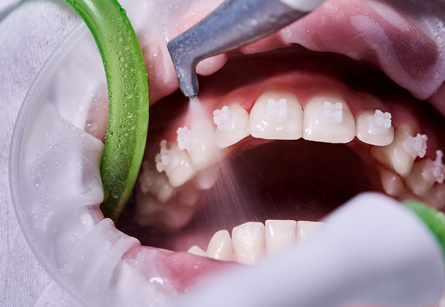 Periodontology: Definition, Methods and More